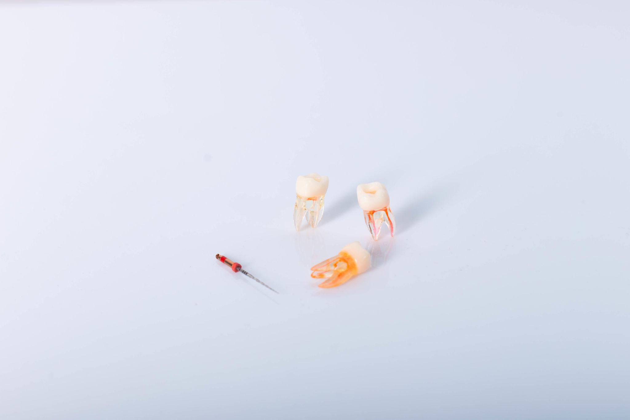 Close-up van endodontische instrumenten tijdens een wortelkanaalbehandeling